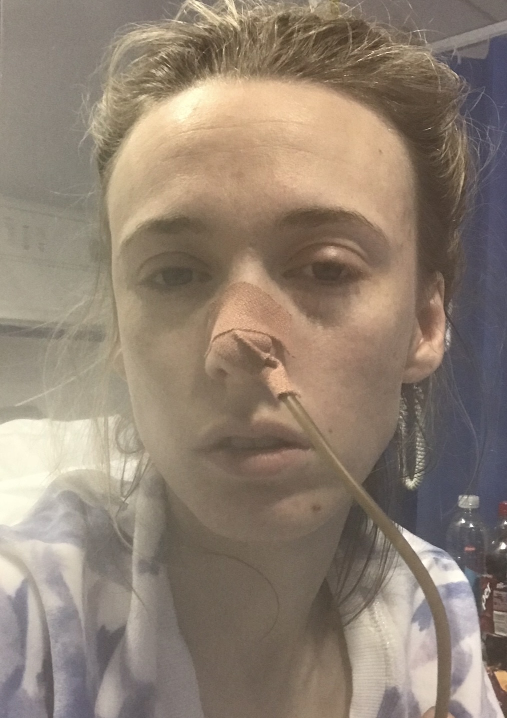 Close-up of Monica Thomas in a hospital bed with a nasogastric tube taped to her nose, looking visibly unwell and exhausted.