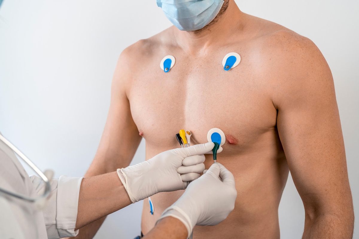 The Cardisio test uses five electrode