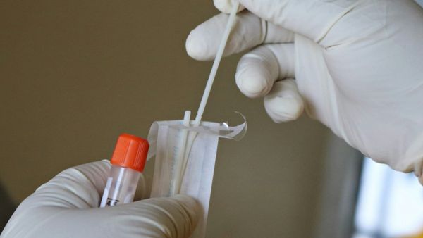 Free HIV and syphilis testing kits available in Suffolk
