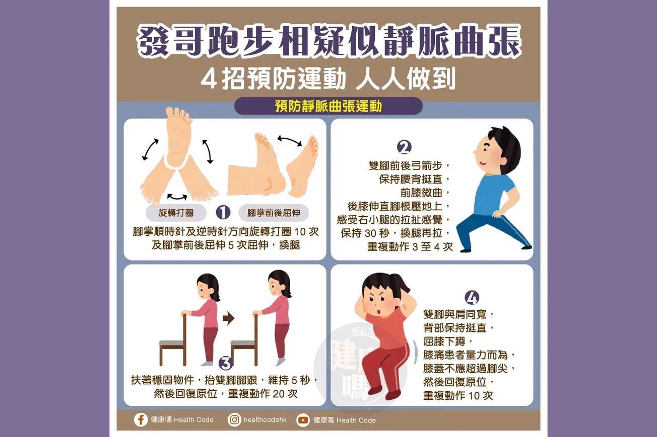 發哥跑步相疑似靜脈曲張 4招預防運動 人人做到