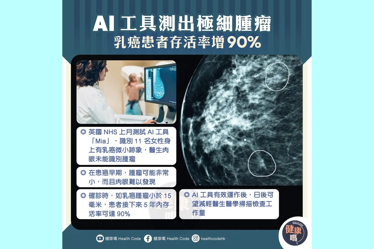 AI工具測出極細腫瘤 乳癌患者存活率增90%