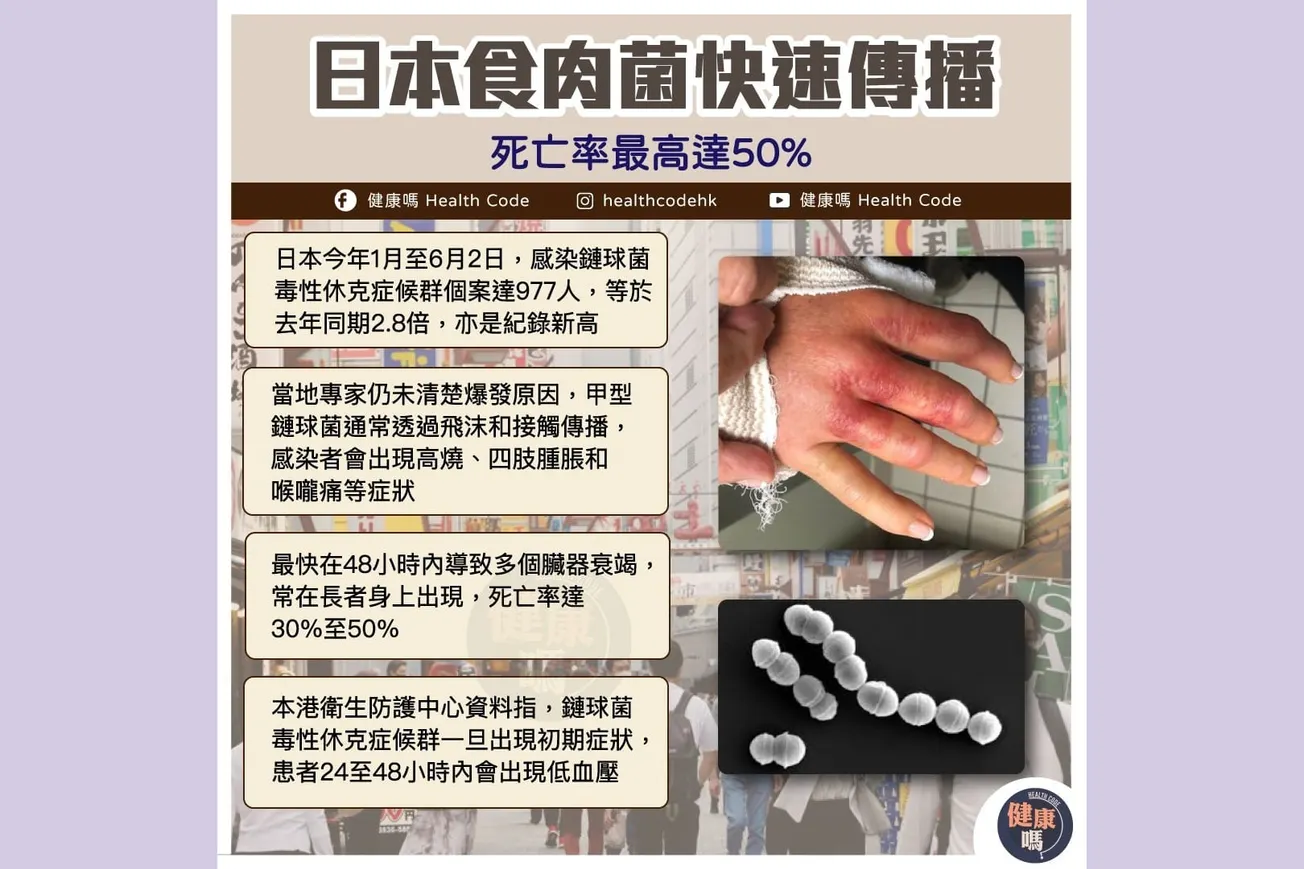 日本食肉菌快速傳播 死亡率最高達50%