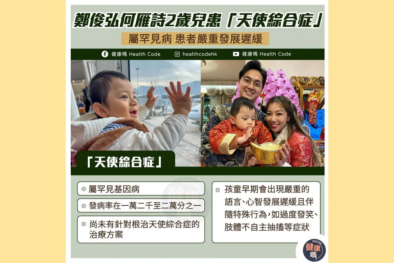 鄭俊弘何雁詩2歲兒患「天使綜合症」 屬罕見病 患者嚴重發展遲緩