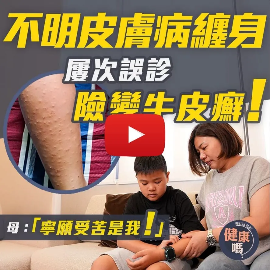 8歲童手腳突然滿粒粒 痕癢難耐｜不明皮膚病 最壞可致牛皮癬｜多番誤診 正確治療半年徹底斷尾