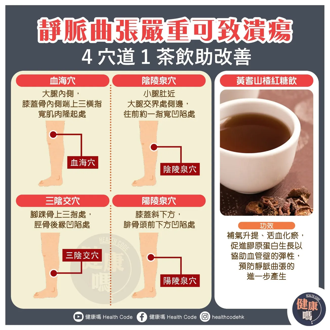 靜脈曲張嚴重可致潰瘍 4 穴道 1 茶飲助改善