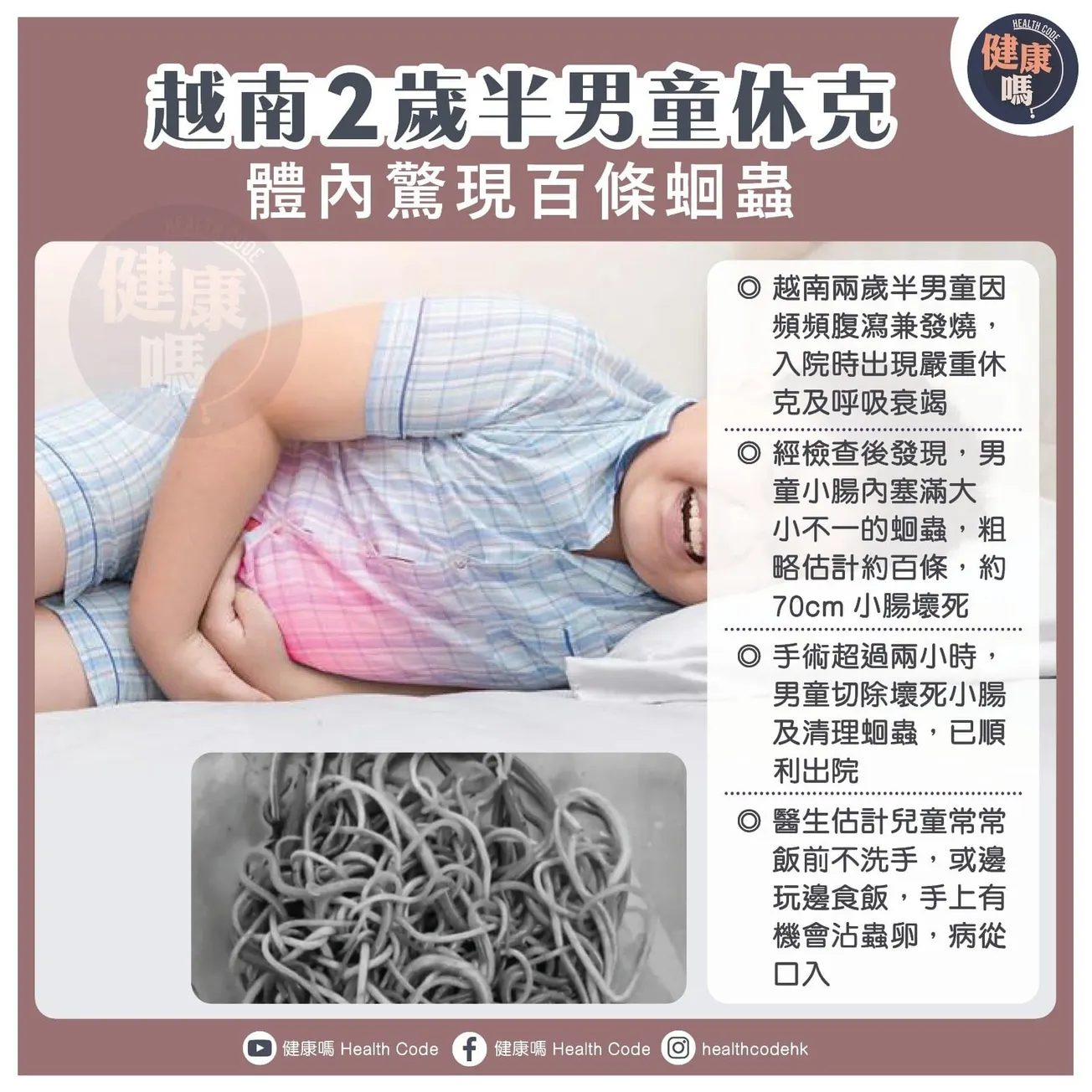 越南 2 歲半男童休克 體內驚現百條蛔蟲