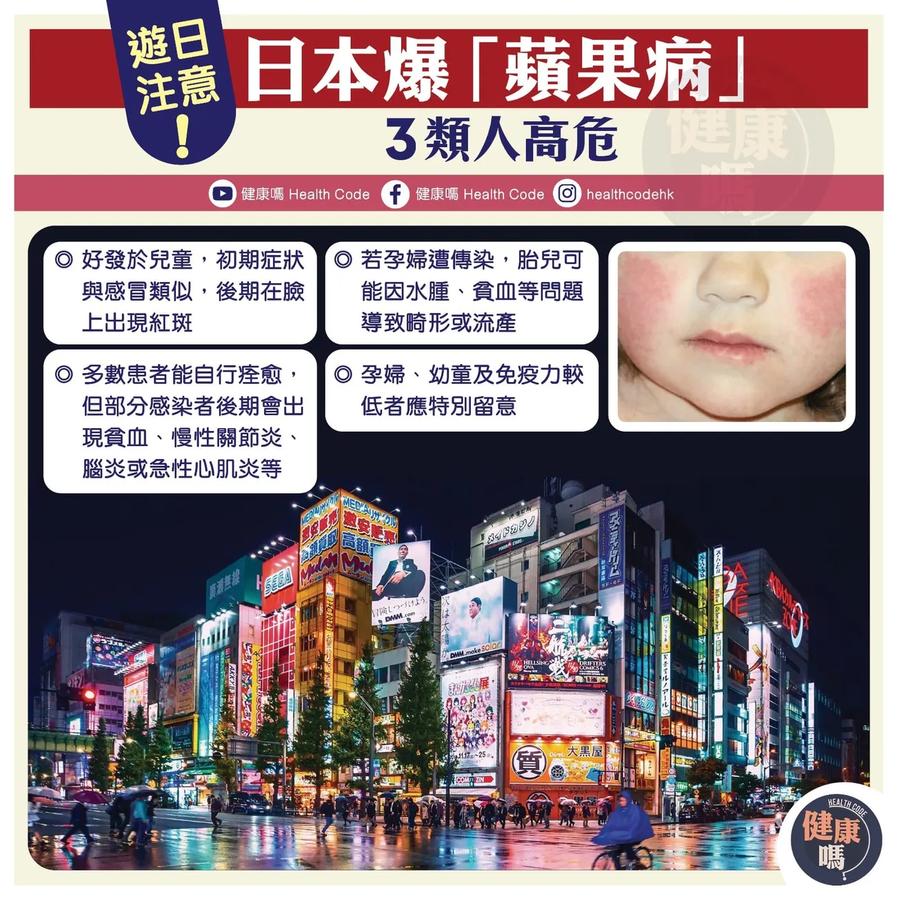 遊日注意：日本爆「蘋果病」 3類人高危