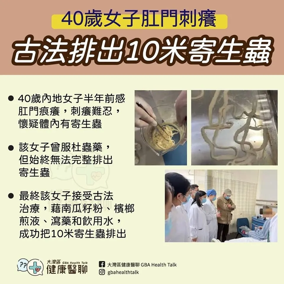 40歲女子肛門刺癢 古法排出 10 米寄生蟲