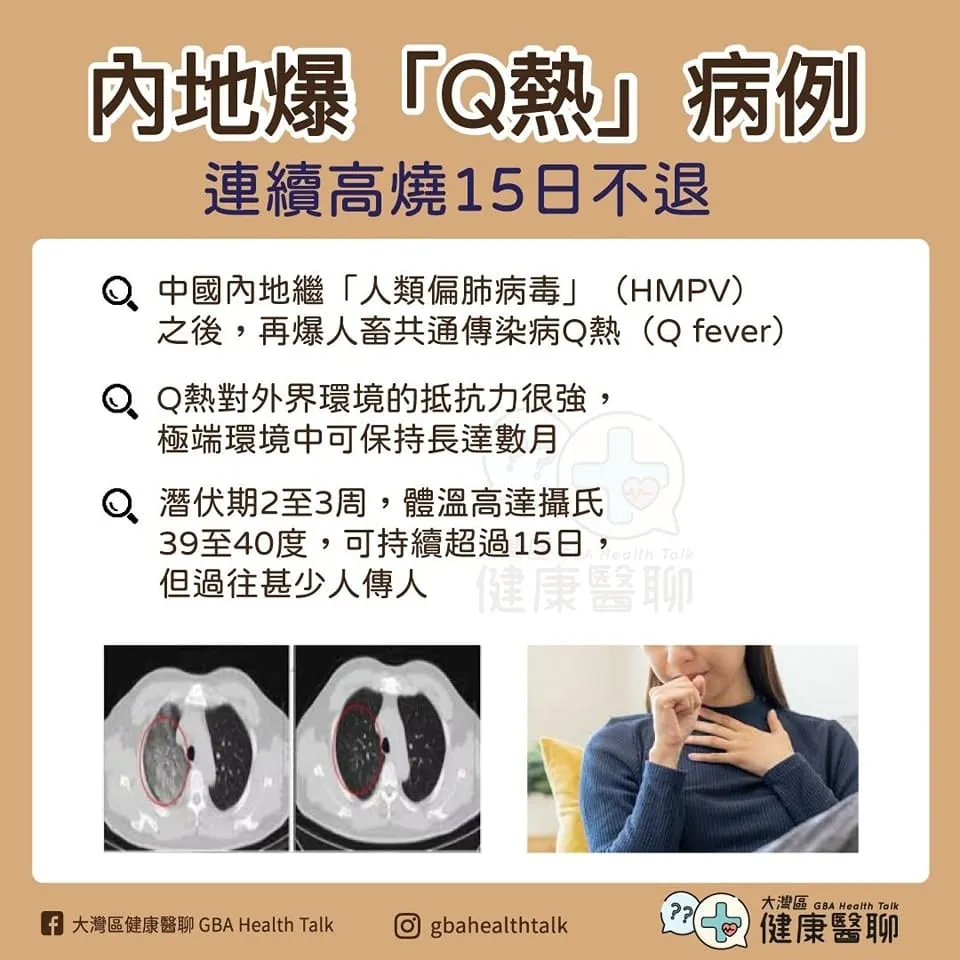 內地爆「Q熱」病例 連續高燒 15日不退