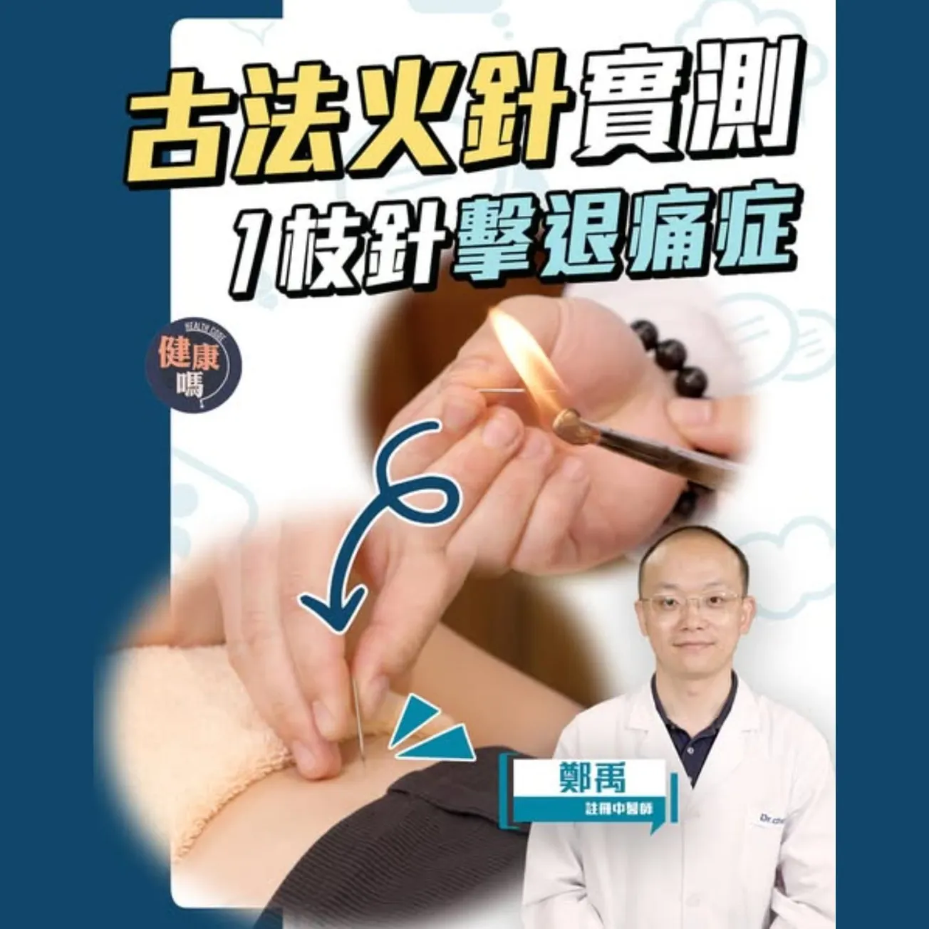 古法火針真人實測 1枝針擊退痛症｜五十肩 中風 面癱 濕疹 生蛇 慢性皮膚病｜驅風止癢 溫經散寒