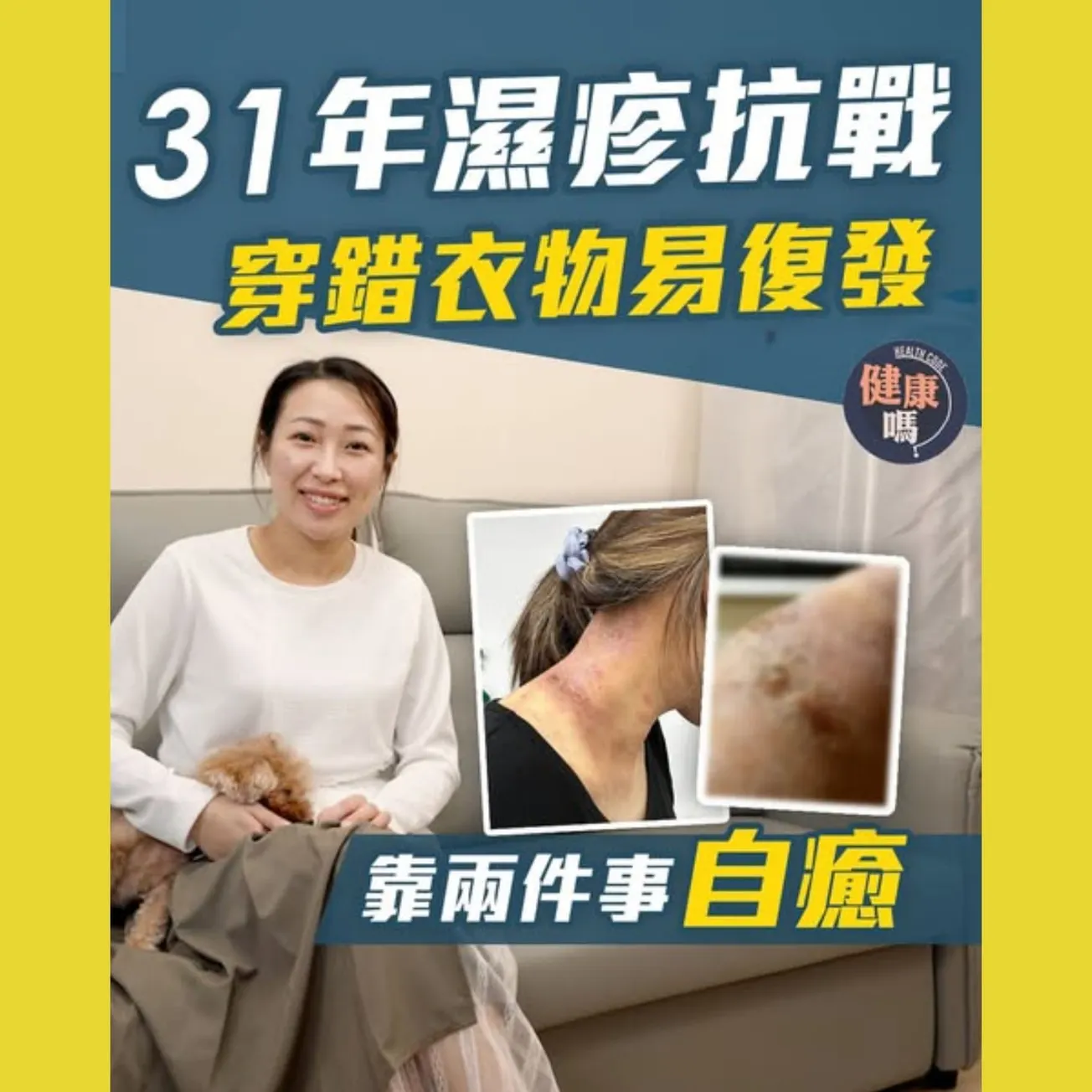 濕疹4年痛不欲生 靠「綁手腳」入睡 做對一些事成功逆轉｜穿錯衣物濕疹惡化 避穿5大物料｜何學工醫生：棉質衣物不適用於所有人