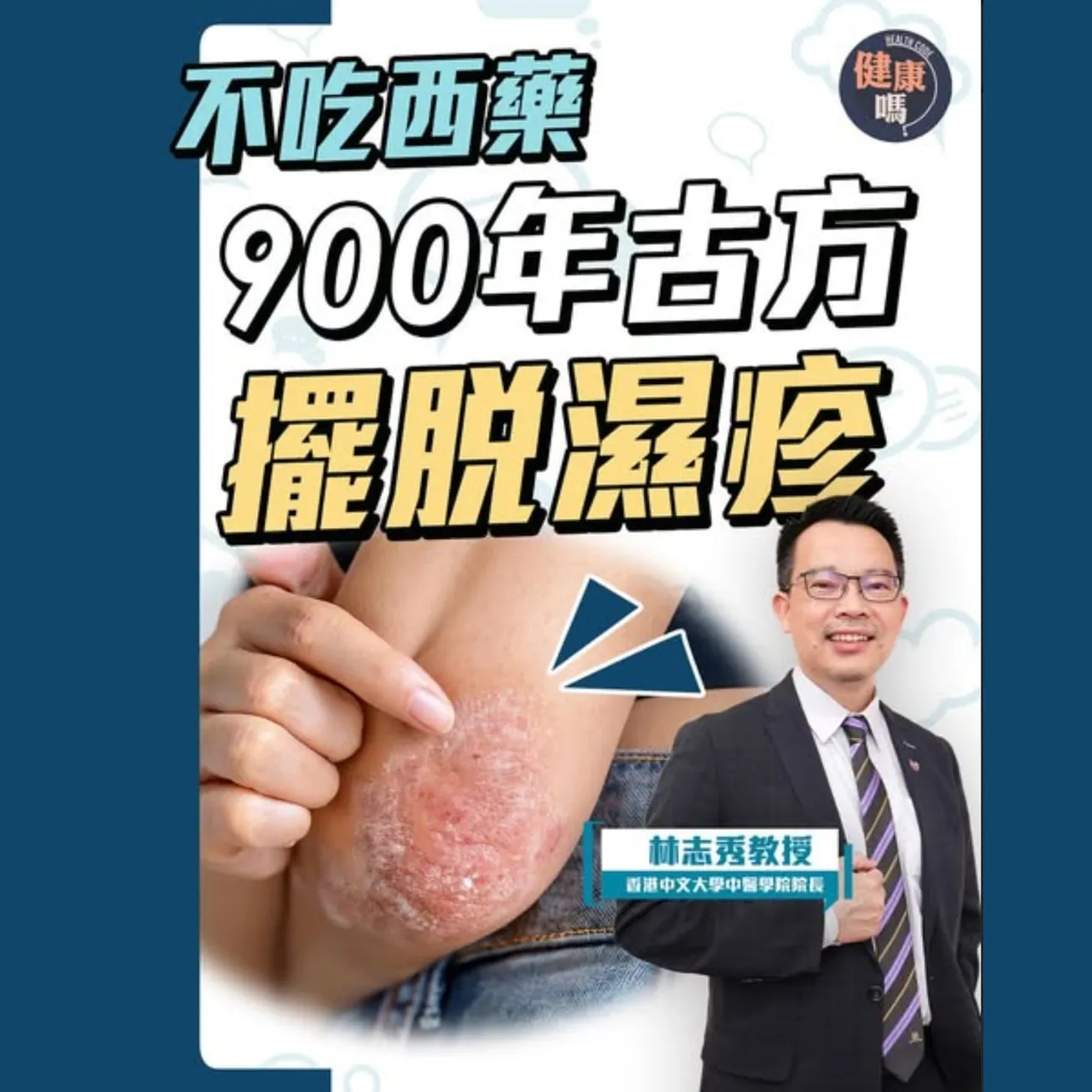 濕疹真相：疫苗惹禍？戒口無用？金銀花沖洗存疑？｜3大不良習慣 害你後天濕疹爆發｜不吃西藥 900年古方擺脫痕癢