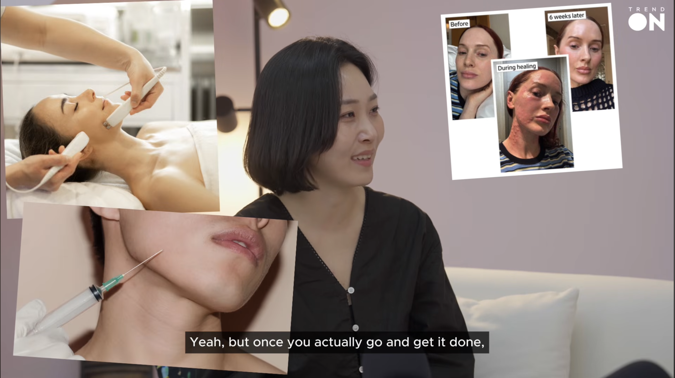 Trend On EP.1 host discusses clinic-grade skincare at home. Background images show a woman receiving a facial device treatment, a syringe injection near the chin, and a before-during healing-6 weeks later comparison of a patient who underwent a clinical skin procedure. Subtitle: Yeah, but once you actually go and get it done. Source: trendier AI Trend On EP.1.