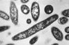 My Mom Was a Legionnaires' Expert. That Didn't Save Her From the Outbreak