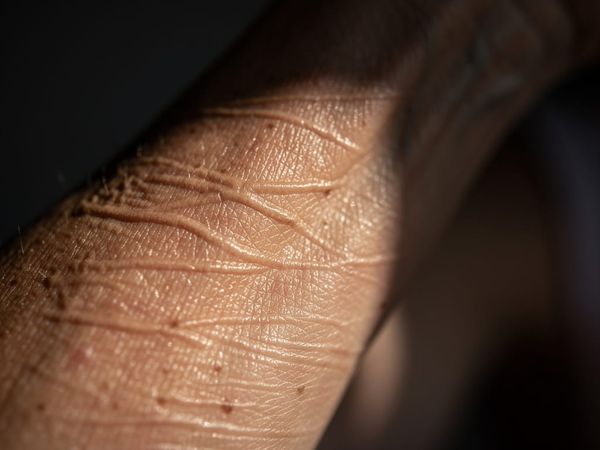 The Hidden Cause of Crepey Skin Nobody Talks About