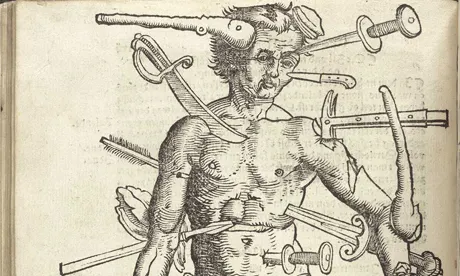 Wound Man Gersdorff