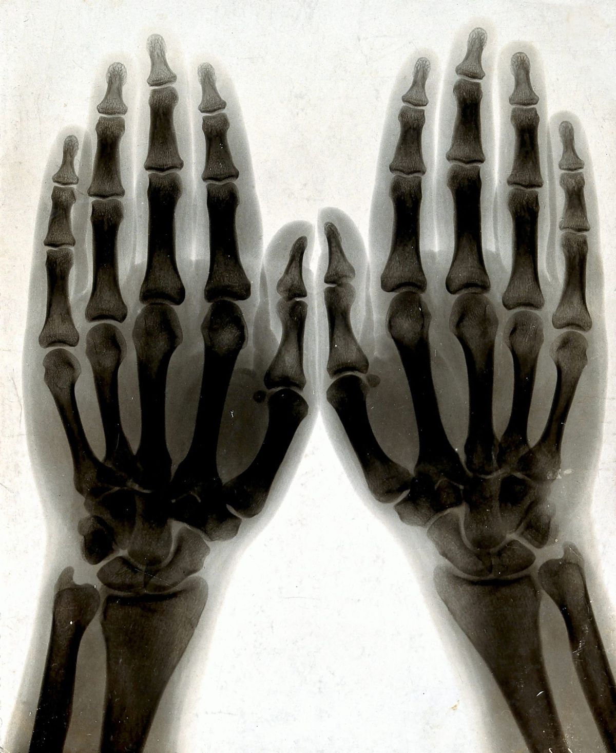 Sixty Years on One Hand