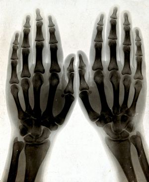 Sixty Years on One Hand