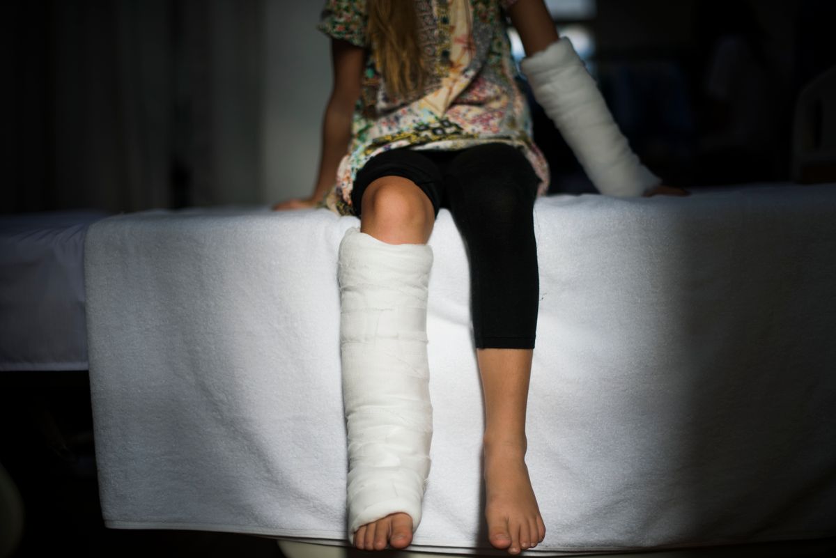 Kids with Casts. When Was The Last Time You Saw One?