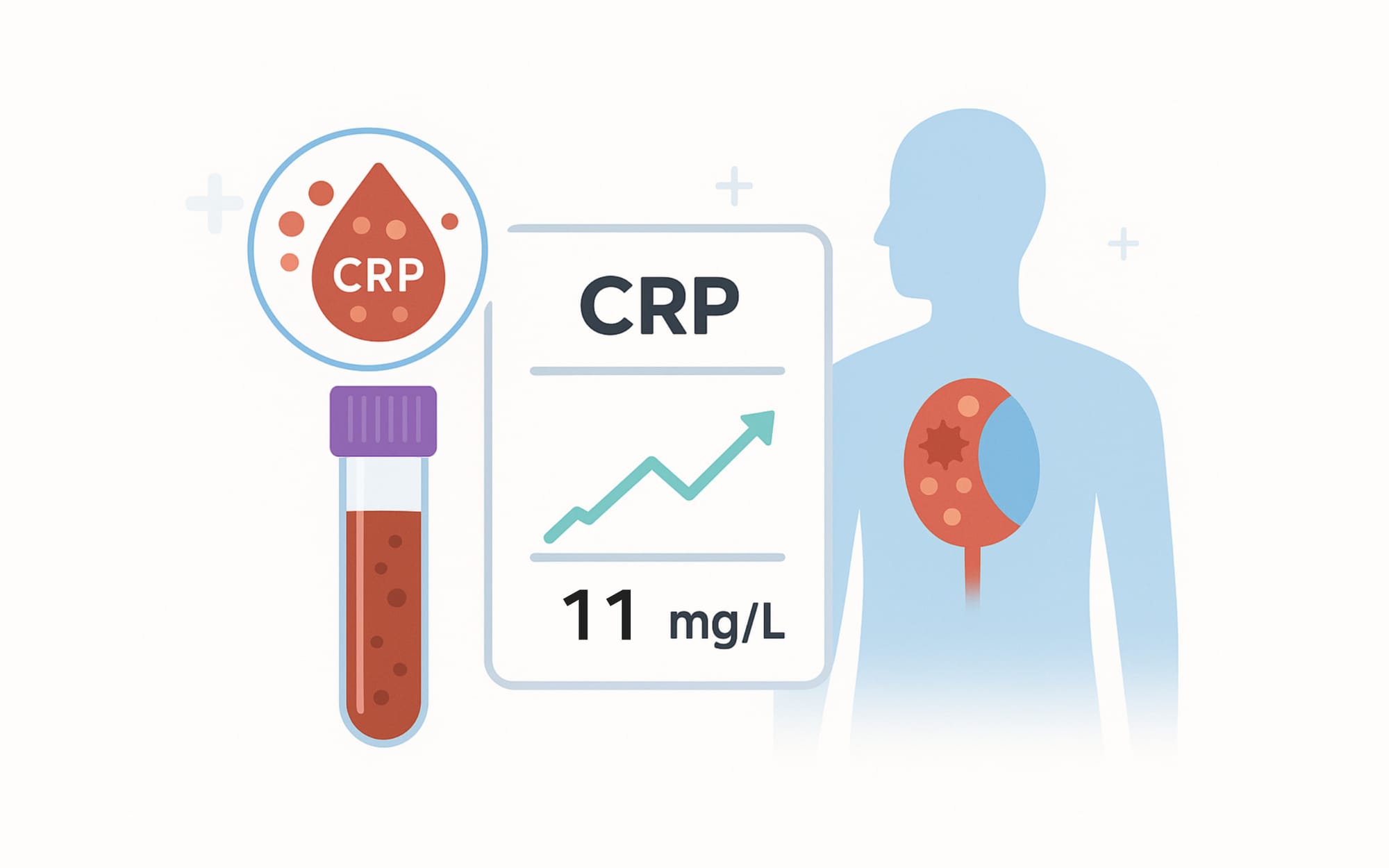 CRP 검사에 대한 설명을 표현한 그림