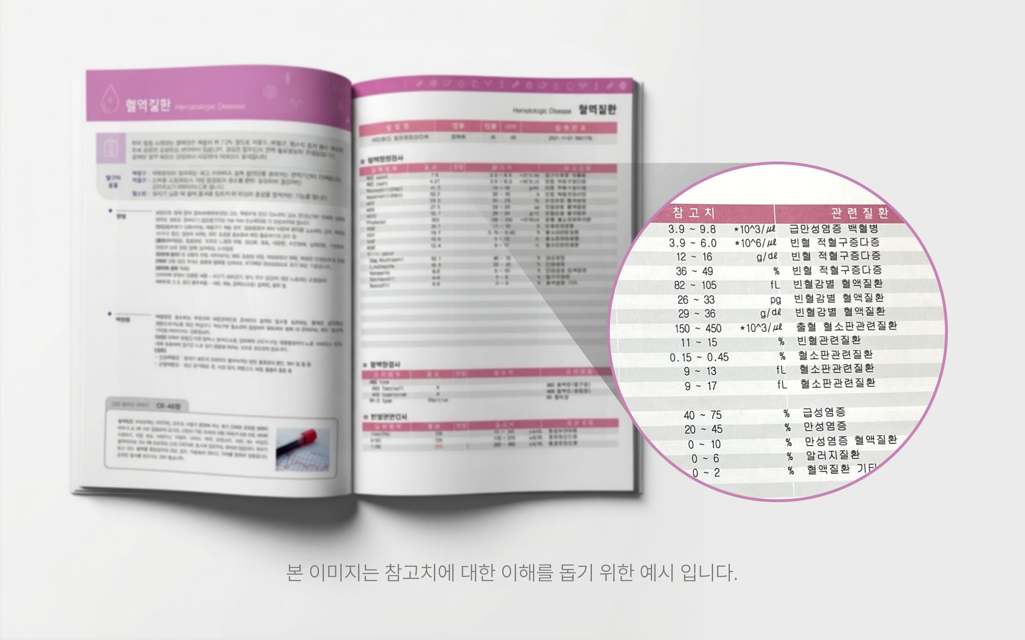 정상 참고치에 대한 이해를 돕기위한 예시 이미지