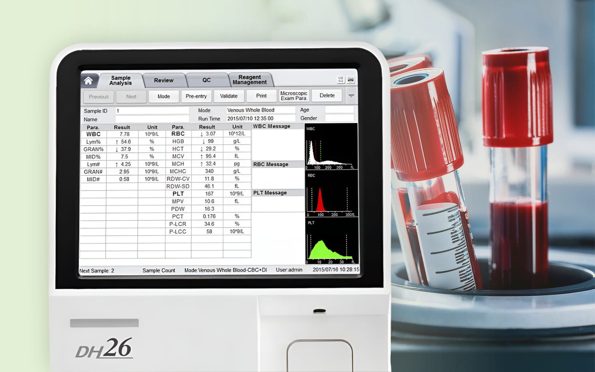 임상병리사 실무 TIP! 히스토그램으로 보는 CBC 데이터 검증법