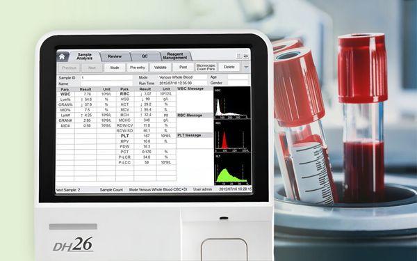 임상병리사 실무 TIP! 히스토그램으로 보는 CBC 데이터 검증법