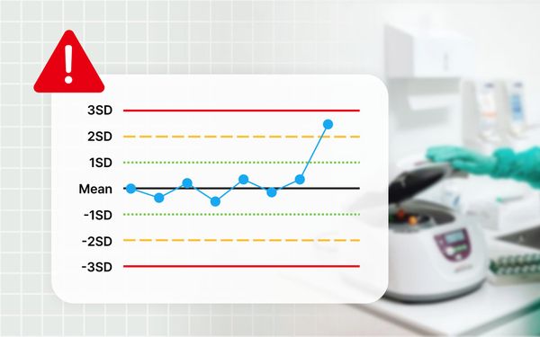 Levey-Jennings 그래프 예시 모습