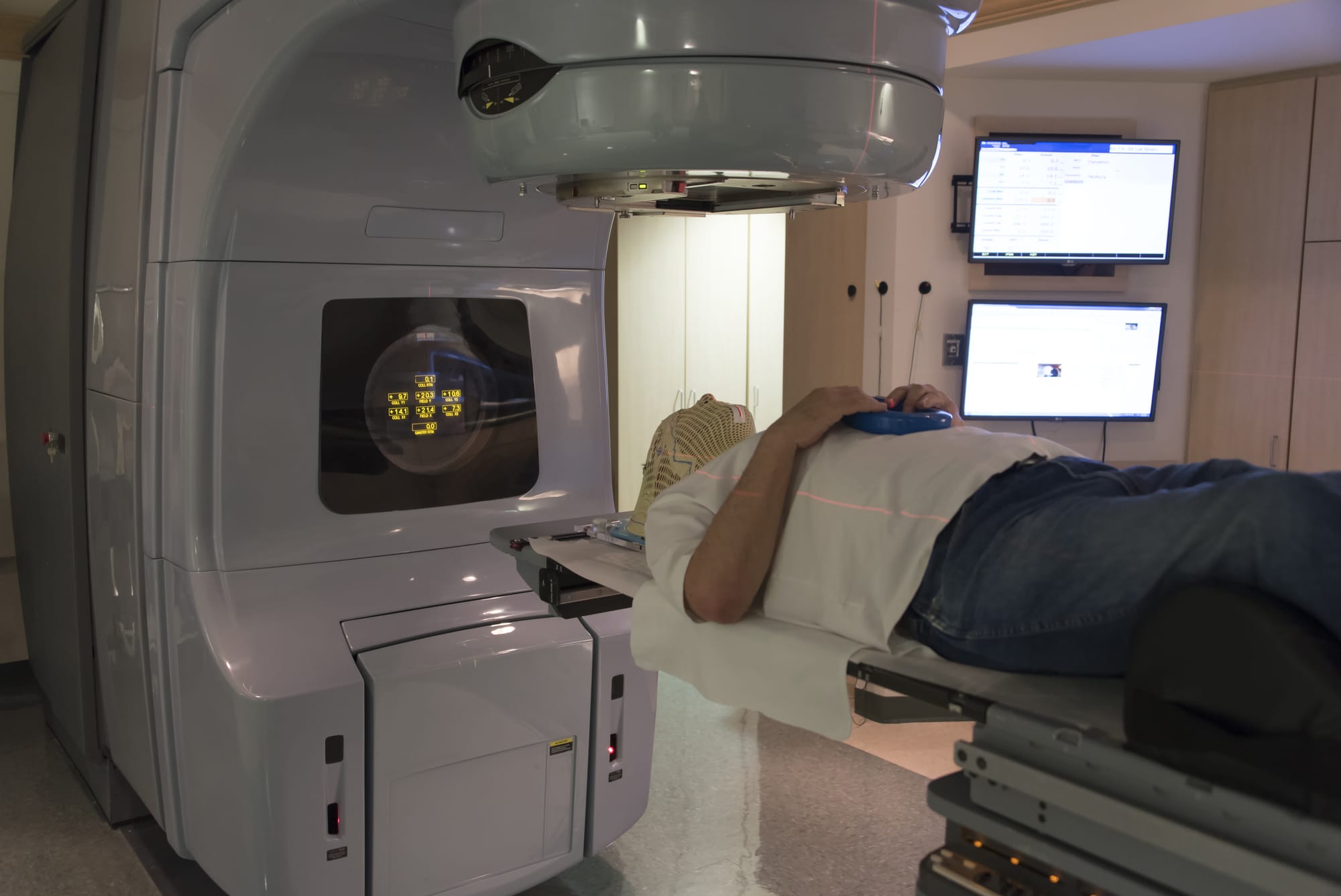 Using radiation therapy to treat brain tumours