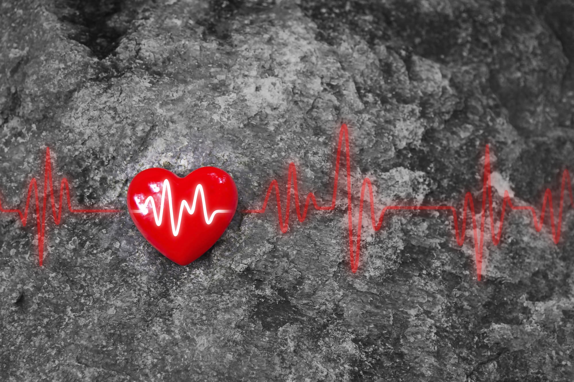 What is hypertrophic cardiomyopathy?