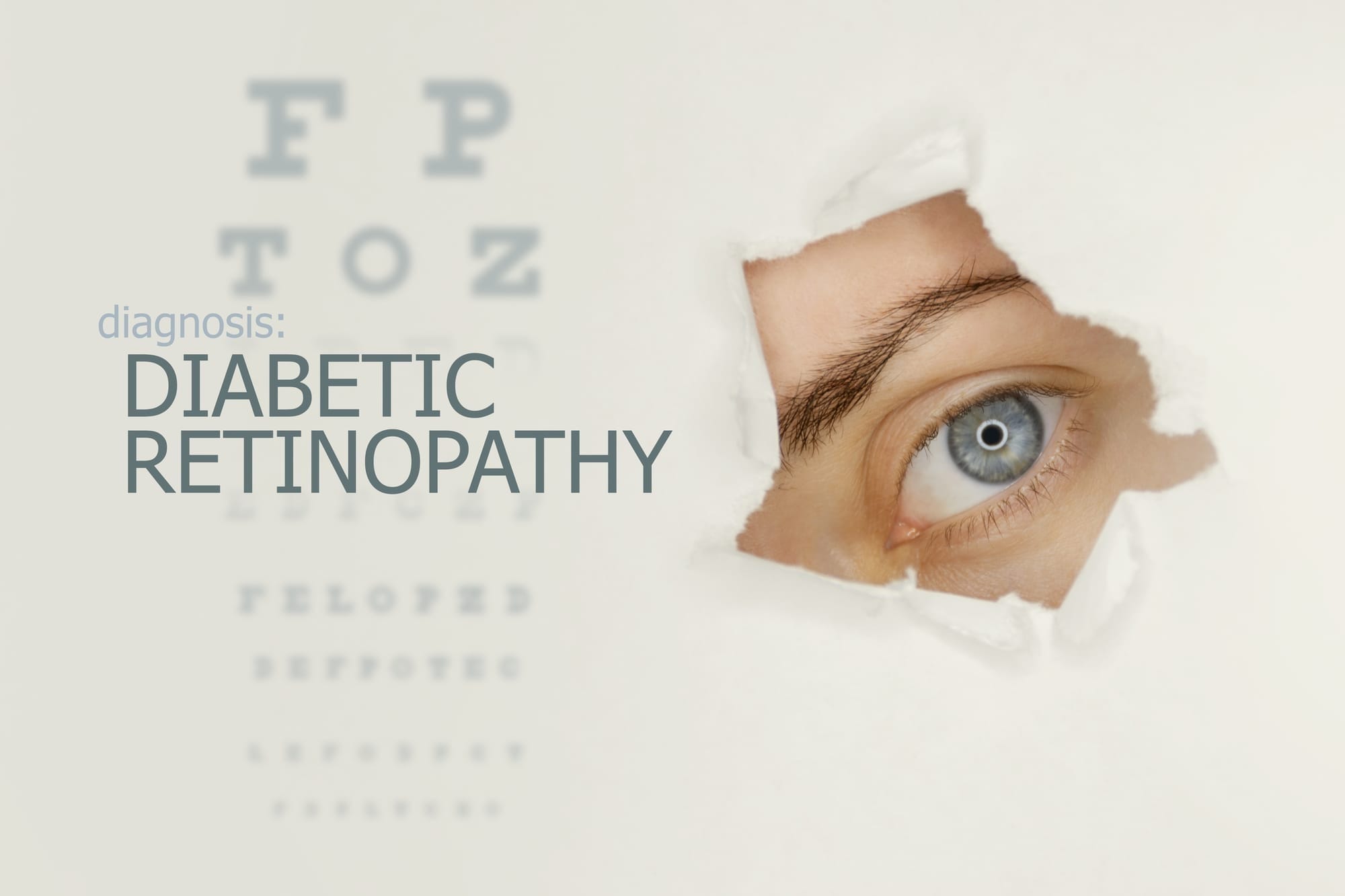 How does diabetes affect your eyes?