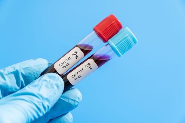 Understanding carrier screening for family planning