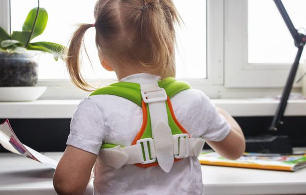 Do children with scoliosis need treatment?