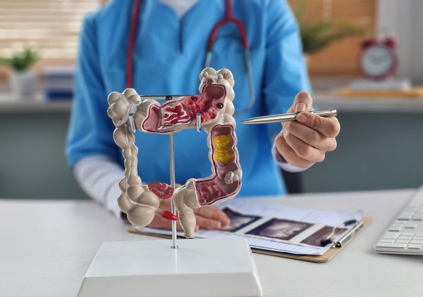 What do you know about colon cancer?
