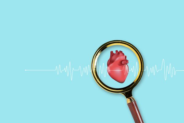 Surprising causes of heart attacks in young women