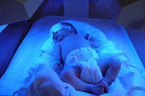 Why treat newborn jaundice with light therapy