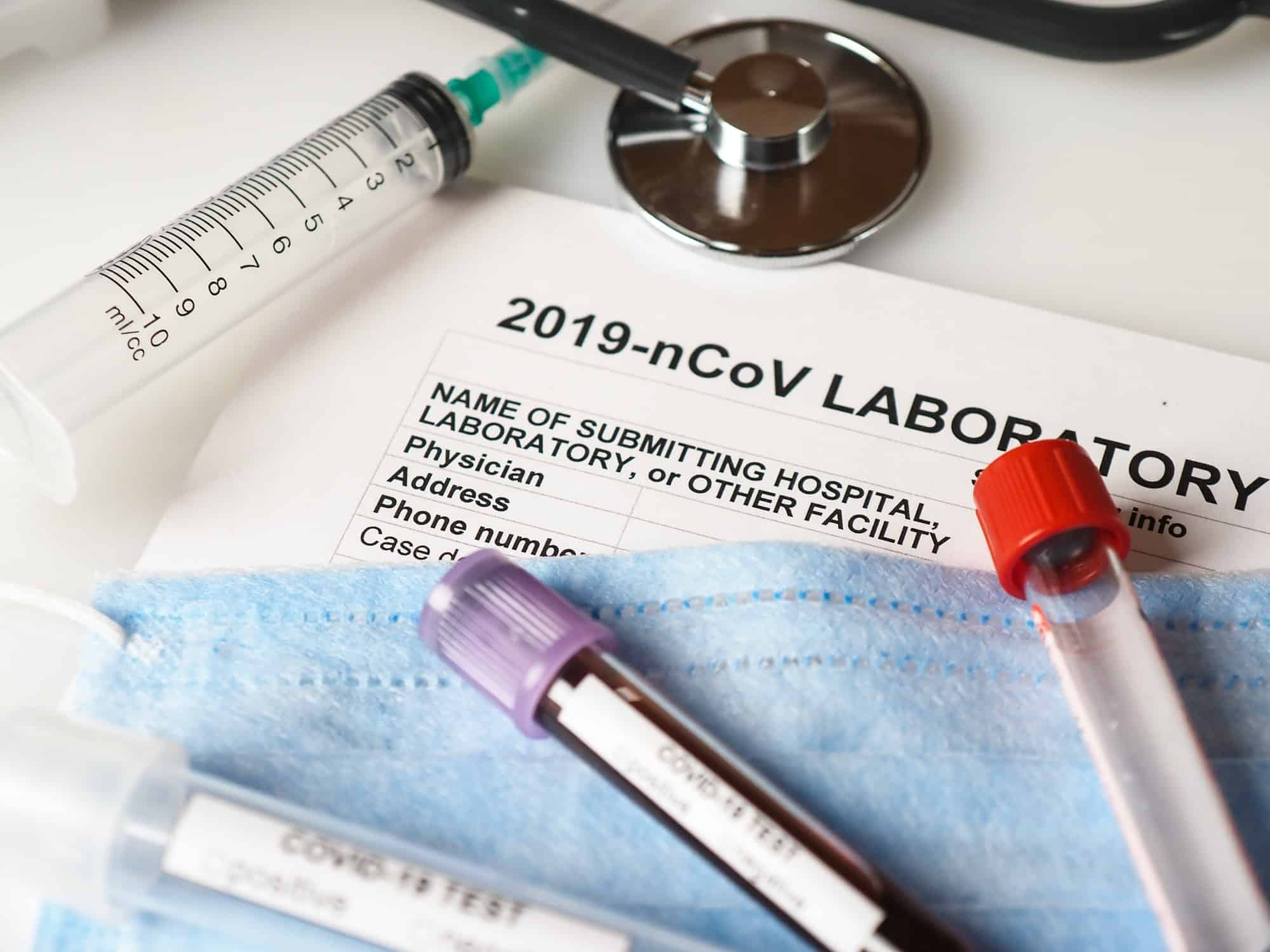 Coronavirus COVID-2019 test concept