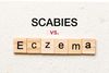 Scabies vs Eczema: The Core Differences