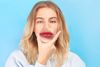 Lip Filler Swelling Timeline: What to Expect and Aftercare