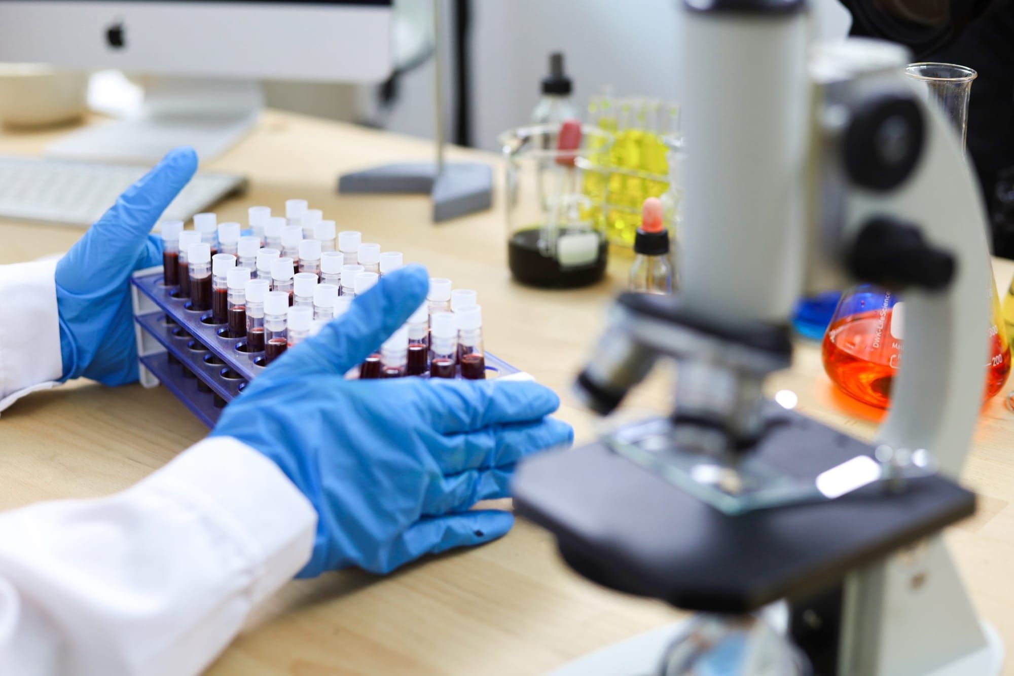 New York City faces loss of over $40 million for HIV prevention services as federal budget proposes deep cuts