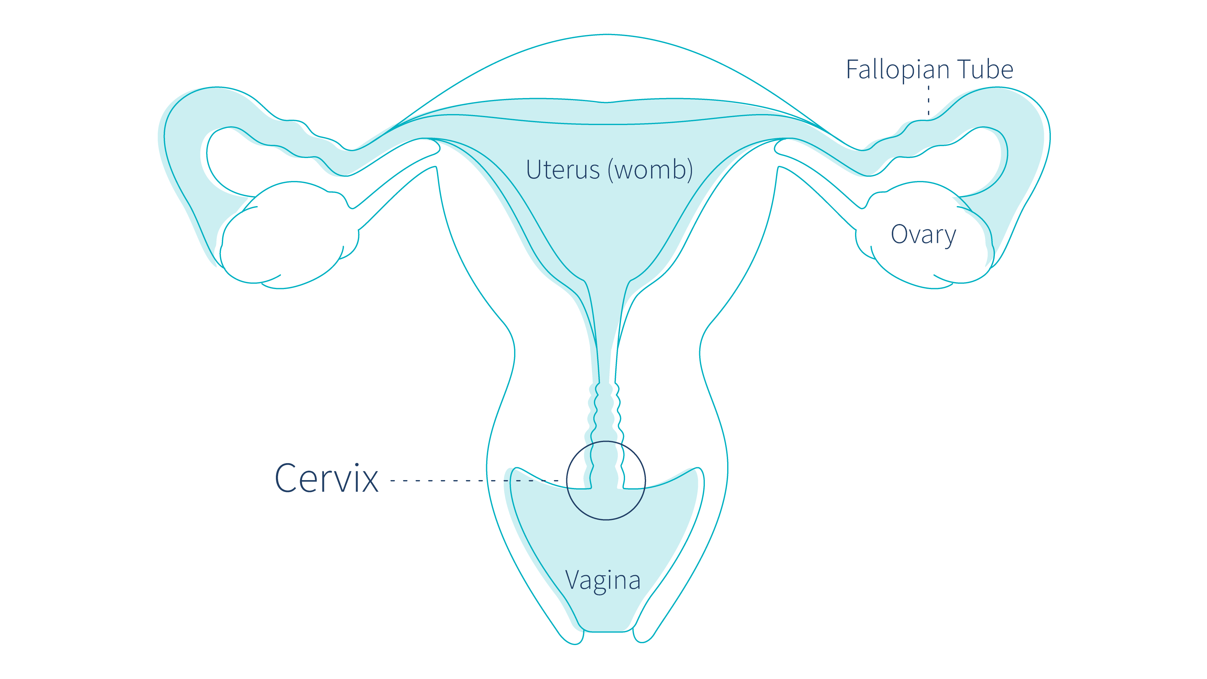 What-Is-Cervical-Cancer---Everything-You-Need-To-Know