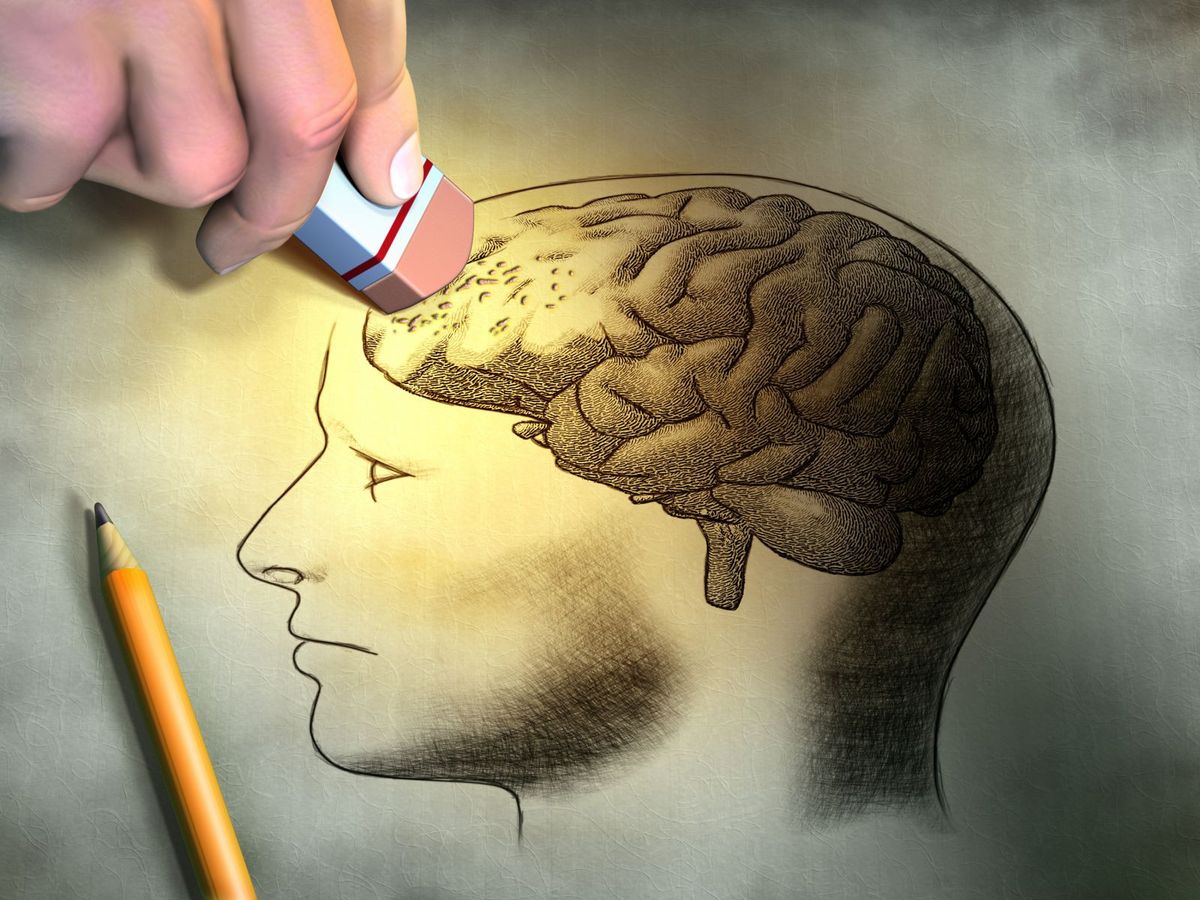 Entropic Brain Hypothesis