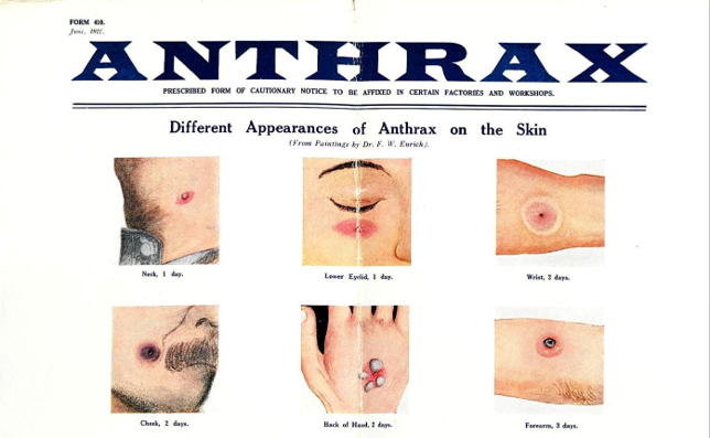 Workers kept dying of "la maladie de Bradford". It was anthrax.