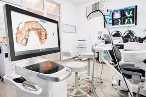 Q&A: Modern Dental (3600 HK)