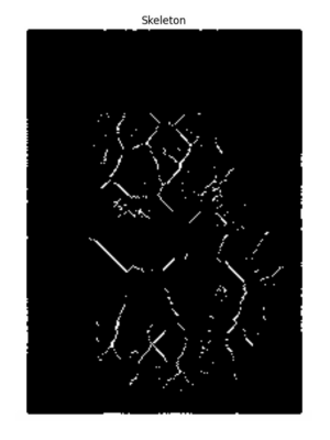 Skeleton image in OpenCV