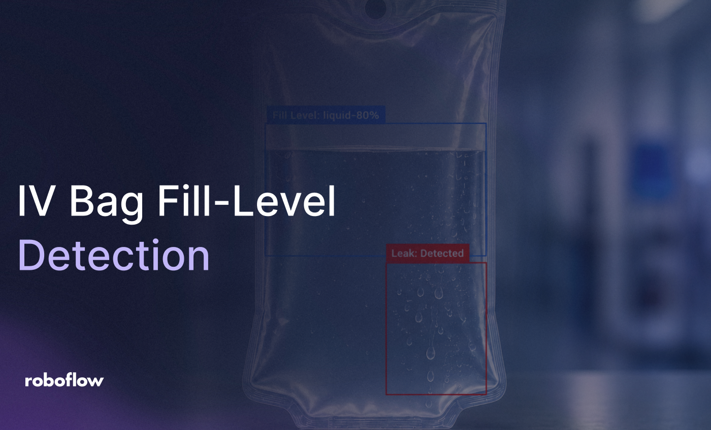 IV Bag Fill-Level and Leak Detection