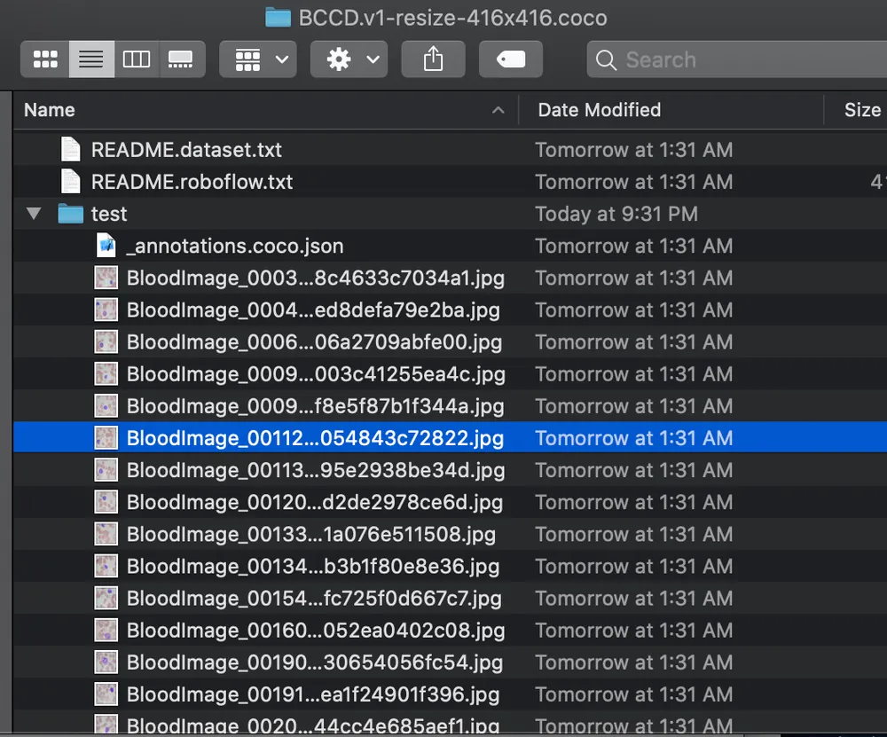 Finder screenshot: BloodImage_00112.jpg