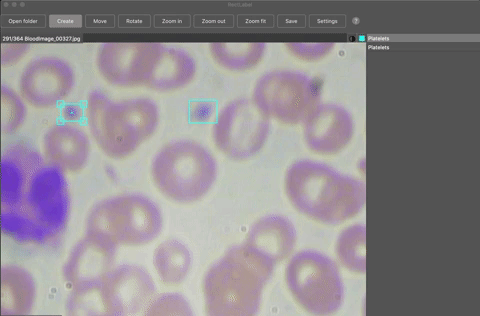 Releasing an Improved Blood Count and Cell Detection (BCCD) Dataset