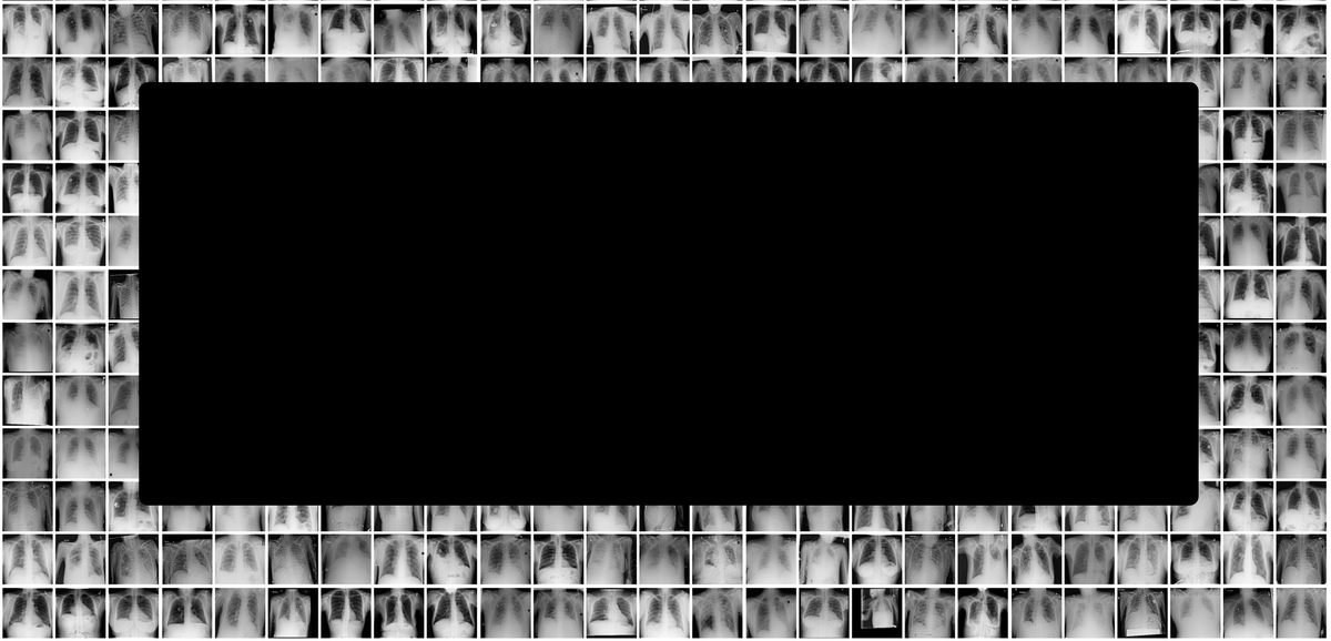 computer vision to fight covid-19