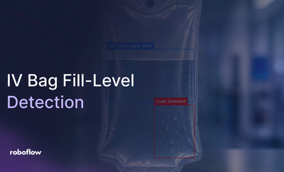 IV Bag Fill-Level and Leak Detection with AI